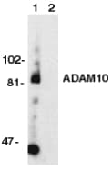 Polyclonal Rabbit anti-Human ADAM10 Antibody (IHC, IF, WB)
