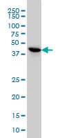 TSSK2 Antibody (clone 1H2)