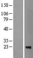 CDCA4 Protein (Over-Expression Lysate Myc-DDK (Flag))