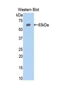 PBRM1 / BAF180 / PB1 Antibody (aa1-306)