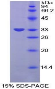 Rat SERPINB2 / PAI-2 Protein (Recombinant His-T7)