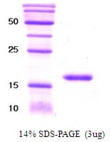 Human KIR3DL1 Protein (Recombinant His)
