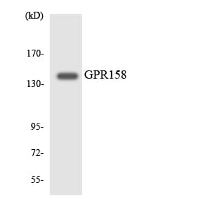 GPR158 Antibody (aa43-92)
