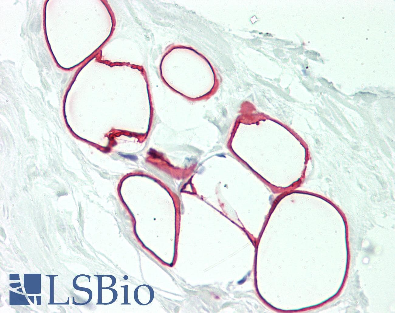 IHC-plus™ SLC25A6 / ANT3 Antibody (aa128-155)