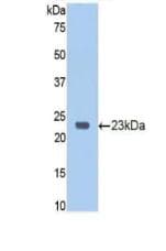 RB1 / Retinoblastoma / RB Antibody (aa753-928)