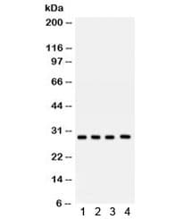 Polyclonal Rabbit anti-Human CA1 / Carbonic Anhydrase I Antibody (IHC, WB)