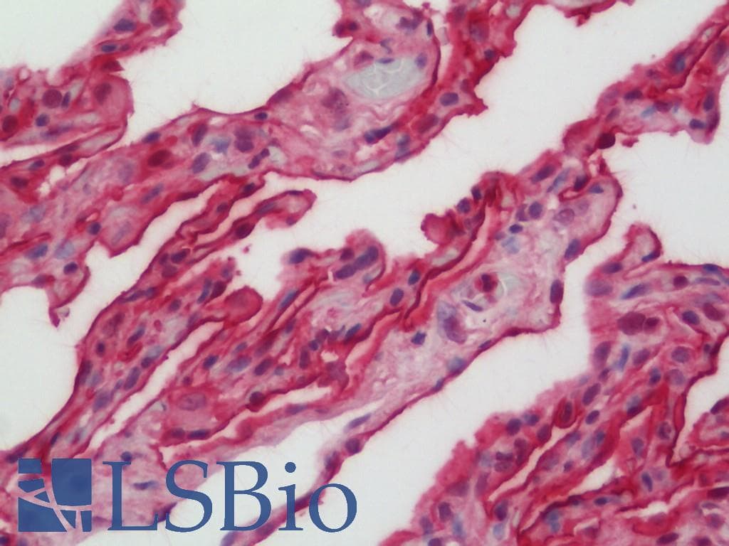 IHC-plus™ CD55 Antibody (aa71-330)