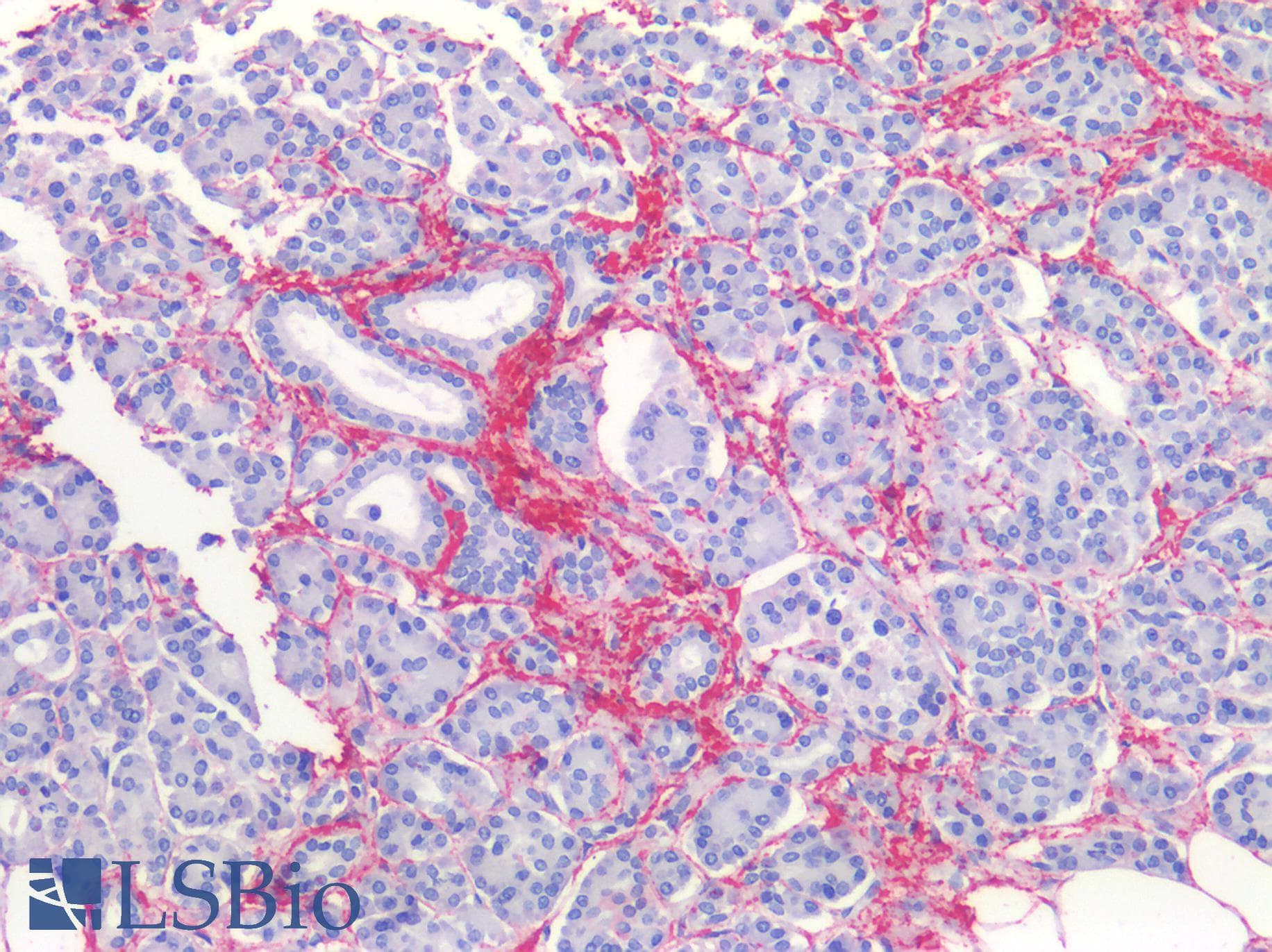 PathPlus™ Monoclonal Mouse anti-Human COL1A1 / Collagen I Alpha 1 Antibody (clone 3G3, IHC, WB)