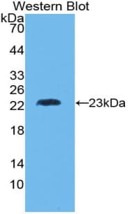 LTA / TNF Beta Antibody (aa36-205, Biotin)