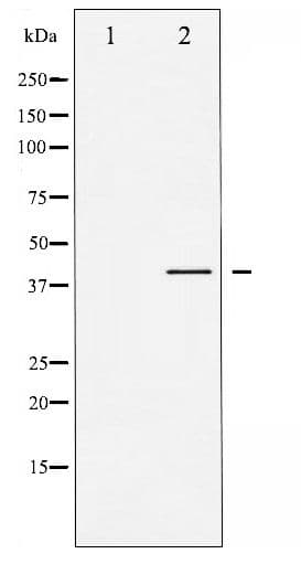 GSK3B / GSK3 Beta Antibody (phospho-Ser9)