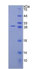 Mouse TNFRSF1A / TNFR1 Protein (Recombinant His)