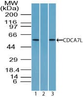 Polyclonal Rabbit anti-Human CDCA7L Antibody (aa170-220, WB)