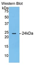TP / Thymidine Phosphorylase Antibody (aa38-247, PE)