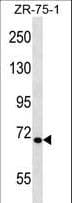 Polyclonal Rabbit anti-Human TEC Antibody (aa26-55, WB)