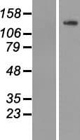 TUBGCP5 / GPC5 Protein (Over-Expression Lysate Myc-DDK (Flag))