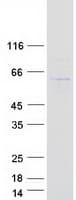 Human MPND Protein (Recombinant Myc-DDK (Flag))