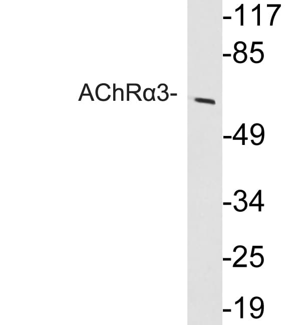 Polyclonal Rabbit anti-Human CHRNA3 Antibody (aa90-139, WB)