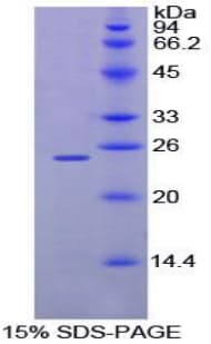 Mouse CD110 / MPL Protein (Recombinant His-T7)