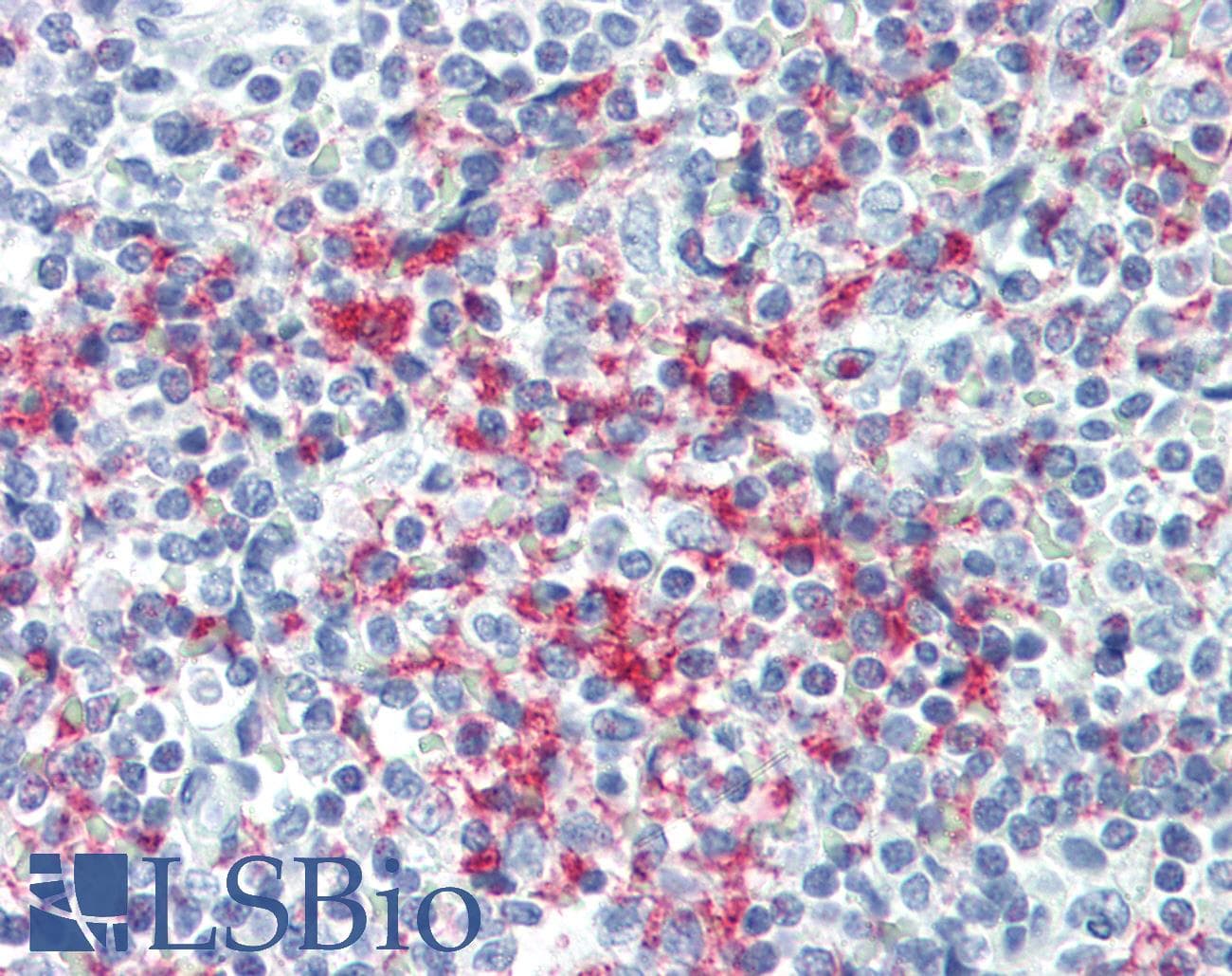 IHC-plus™ GP1BB / CD42c Antibody