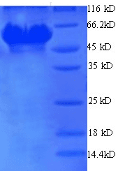 H. pylori Glutamate--tRNA Ligase 1 Protein (Recombinant His)