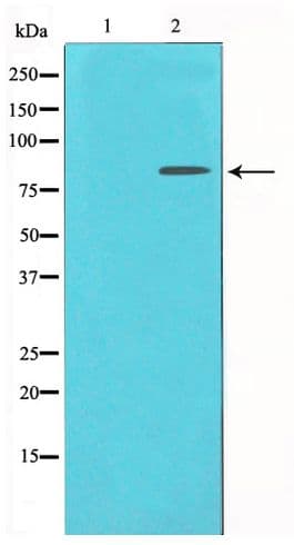 JUP/CTNNG/Junction Plakoglobin Antibody