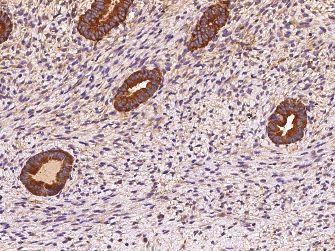 Polyclonal Rabbit anti-Human OXR1 Antibody (IHC)