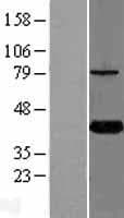 KTI12 Protein (Over-Expression Lysate Myc-DDK (Flag))