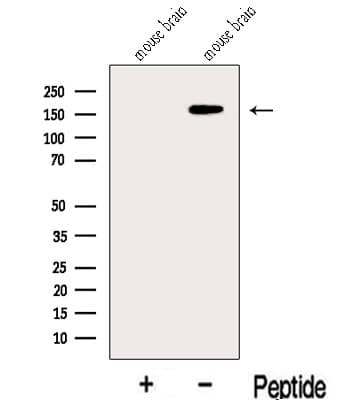 Polyclonal Rabbit anti-Human KDM6B / JMJD3 Antibody (WB)