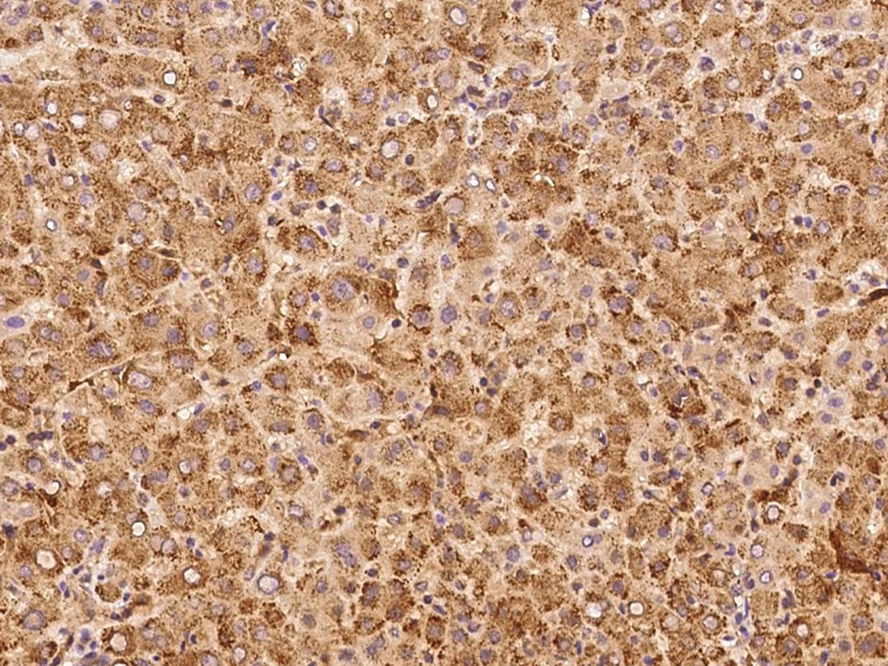 IVD Antibody (Preservative Free)