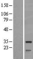 SLC25A10 / DIC Protein (Over-Expression Lysate Myc-DDK (Flag))