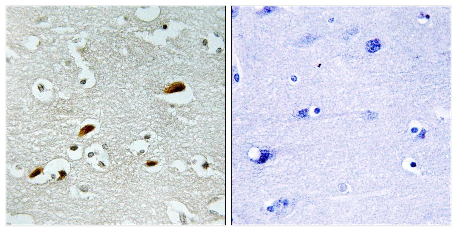 Polyclonal Rabbit anti-Human KAT5 / TIP60 Antibody (IHC)