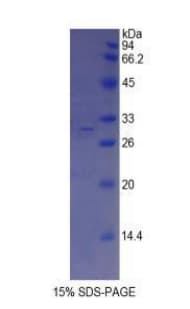 Mouse ABCA1 Protein (Recombinant His)