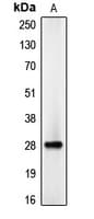 CEBPD + CEBPE Antibody (C-Terminus)