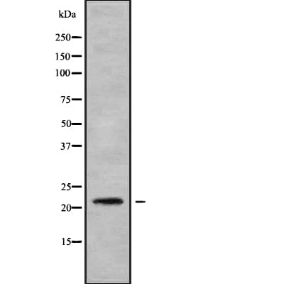 NDUFB8 Antibody