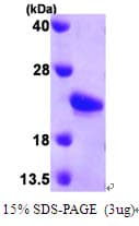Human SHH / Sonic Hedgehog Protein (Recombinant His)
