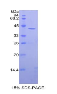 Rat CKM / Creatine Kinase MM Protein (Recombinant His)
