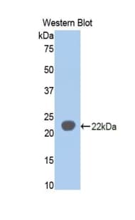 SIGLEC5 / CD170 Antibody (aa18-135)