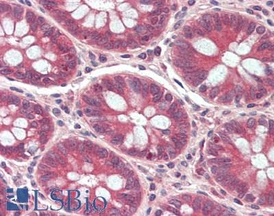 IHC-plus™ IGFALS / ALS Antibody
