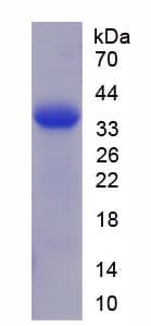 Rat TFF3 / Trefoil Factor 3 Protein (Recombinant His-GST)