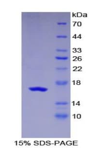 Human CD118 / LIF Receptor Alpha Protein (Recombinant His)