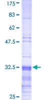 Human TSLP Protein (Recombinant GST, N-terminus)