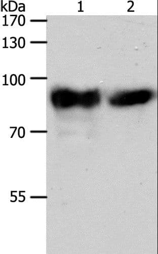 Polyclonal Rabbit anti-Human ACO2 / Aconitase 2 Antibody (IHC, WB)