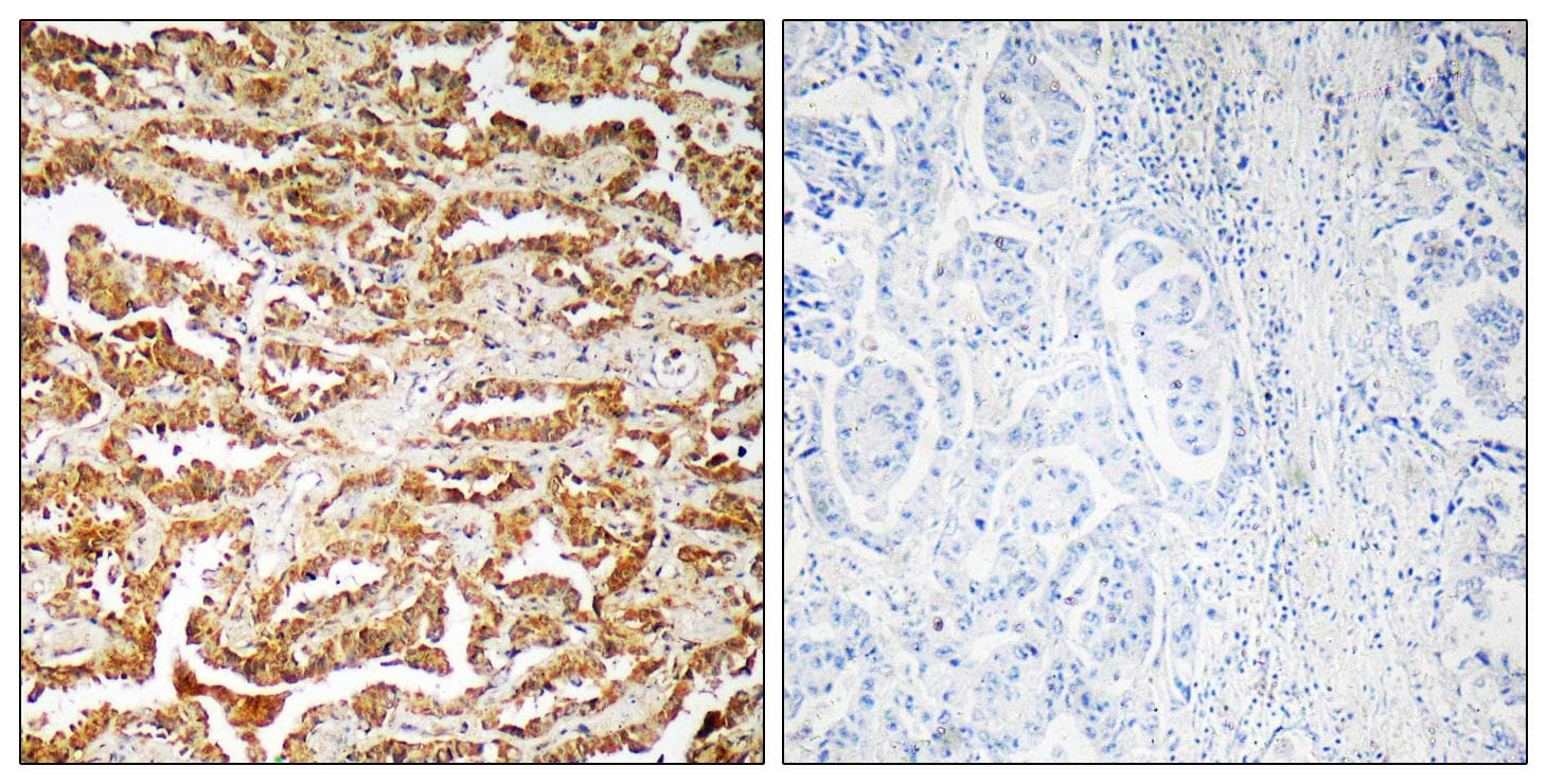 GIT1 Antibody