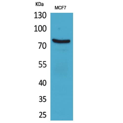 CEACAM5 / CD66e Antibody (471-520 aa, Internal)