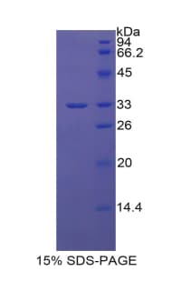 Human CHI3L1 / YKL-40 Protein (Recombinant His-T7)