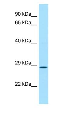 CFDP1 Antibody (C-Terminus)