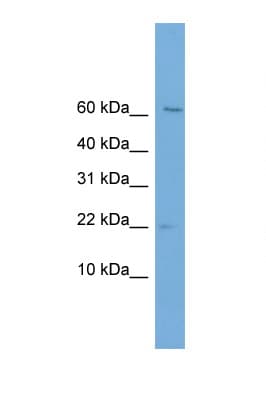 PFDN2 Antibody (C-Terminus)