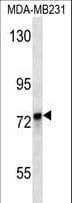 KEAP1 Antibody (aa422-449)