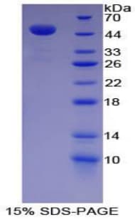 Mouse LF / LTF / Lactoferrin Protein (Recombinant His-GST)