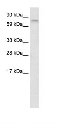 Polyclonal Rabbit anti-Human FUBP1 Antibody (aa40-89, WB)